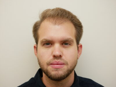 Hair Restoration