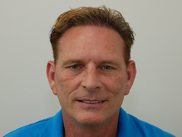 Hair Restoration