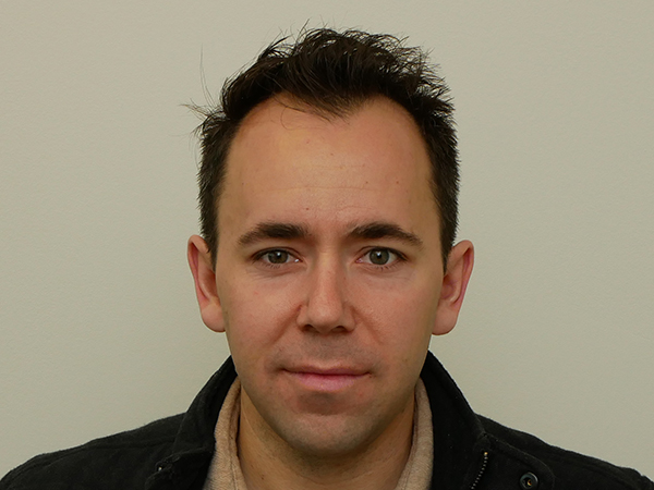 Hair Restoration